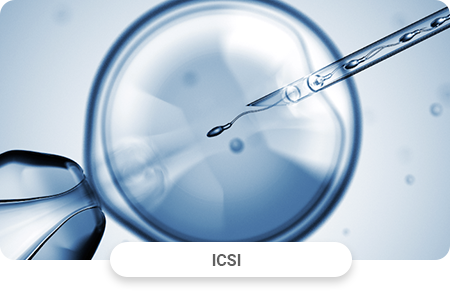 ICSI procedure