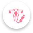 Embryo transfer