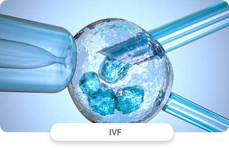 IVF Verfahren
