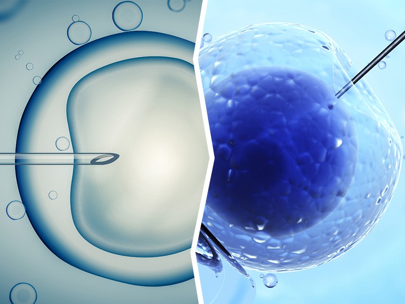 Der Unterschied zwischen IVF und IUI